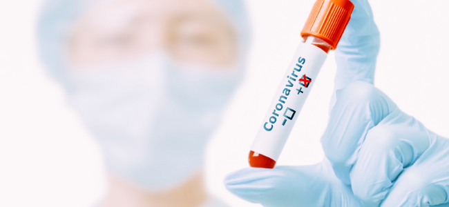 antibody Photo by Aleksei Poprotskii
